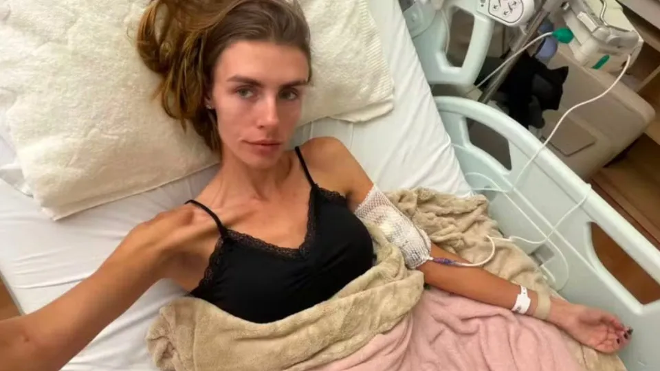 Modelo fala sobre internação em estado grave por anorexia