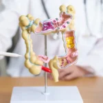 Pacientes com câncer colorretal têm medicamento aprovado pela Anvisa