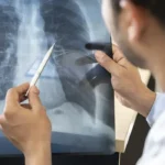 Tabagismo atinge 19% dos jovens de 16 a 24 anos, aponta pesquisa