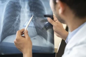 Tabagismo atinge 19% dos jovens de 16 a 24 anos, aponta pesquisa