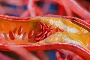 5 alimentos ricos em proteína que também têm muita gordura; veja quais