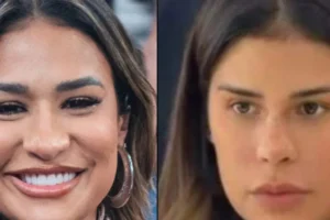 Como ela ficou assim? Os procedimentos estéticos que as famosas fizeram