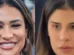 Como ela ficou assim? Os procedimentos estéticos que as famosas fizeram
