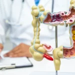 Em 13 anos, doença inflamatória intestinal cresce 5 vezes no Brasil