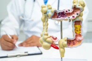 Em 13 anos, doença inflamatória intestinal cresce 5 vezes no Brasil