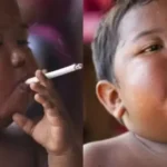 Lembra dele? Veja como ficou o menino que fumava 40 cigarros por dia