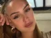 Miss morre aos 22 anos após batalhas contra doença rara