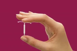 Planos de saúde passam a cobrir DIU hormonal contra endometriose