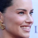 Rinoplastia: Os narizes de famosos mais copiados