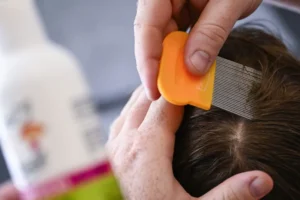 Verdades e mentiras sobre piolhos: o que diz a Ciência