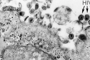 Vírus HTLV-1 causa síndrome inflamatória em assintomáticos, aponta estudo