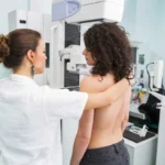 5 fatores do cotidiano que podem alterar o risco de câncer de mama