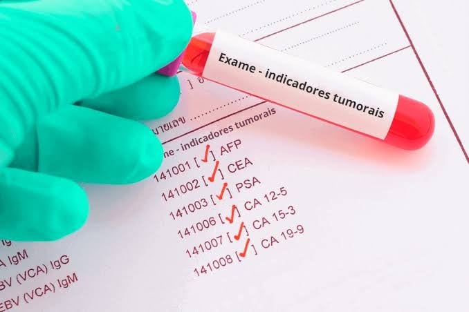 Exame de sangue que rastreia mais de 50 cânceres chega ao Brasil