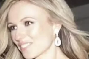 Mulher descobre agulha no abdômen após sete anos de dores nos EUA