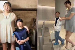 Quem era Xiao Yue, influenciadora com mais de dois metros de altura que morreu aos 26 anos